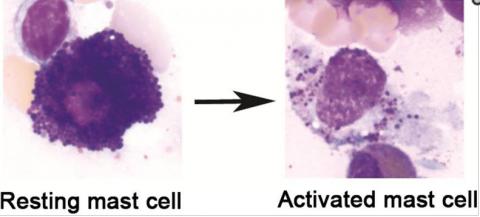 MCAD: What an activated mast cell looks like