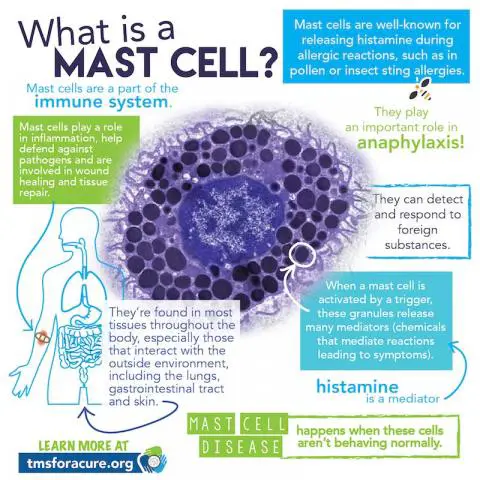 Great printable infographics on mast cell disease