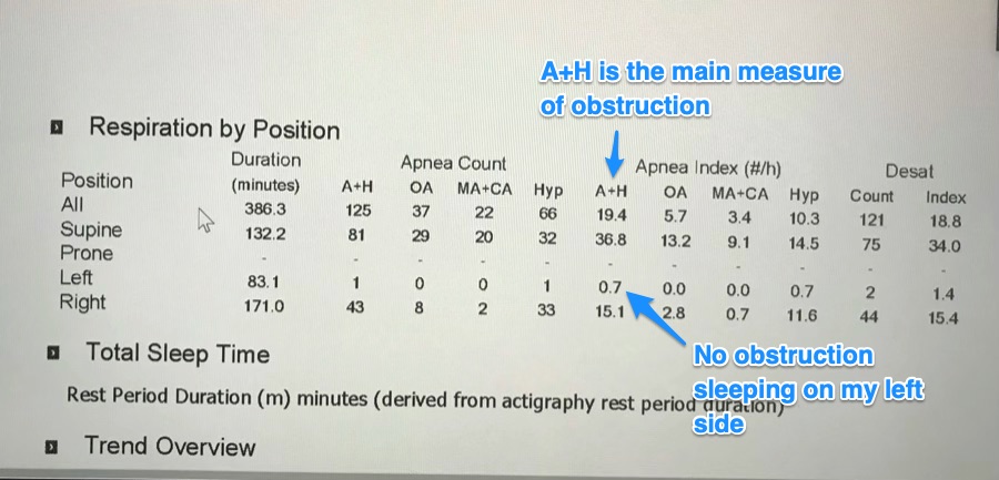 Home Sleep Study Example Results Information Alvinalexander Com   1 Sleep Study Intro A H Left Ok 