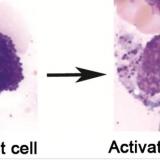 MCAD: What an activated mast cell looks like
