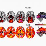 A scientific study to capture images of your brain on LSD