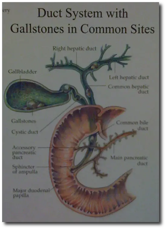 The Gallbladder, Gallstones, and bile ducts