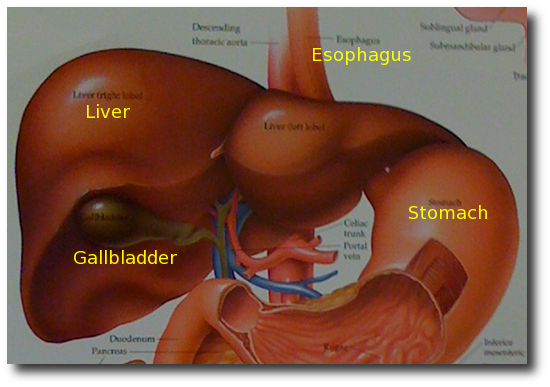 can phentermine cause gallstone